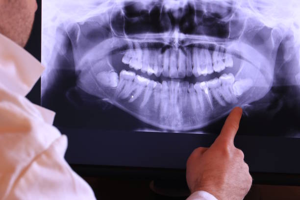 Best Emergency Treatment for Oral Infections in Hudson Falls, NY