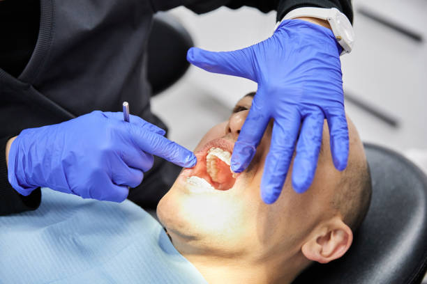 Best Emergency Dental Care for Sports Injuries in Hudson Falls, NY