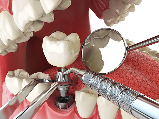 Best Emergency Treatment for Jaw Pain or Injury in Hudson Falls, NY